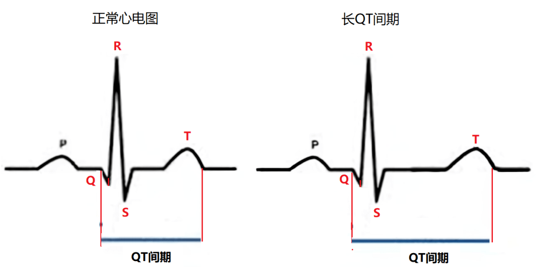 QT间期正常值与SEO优化策略